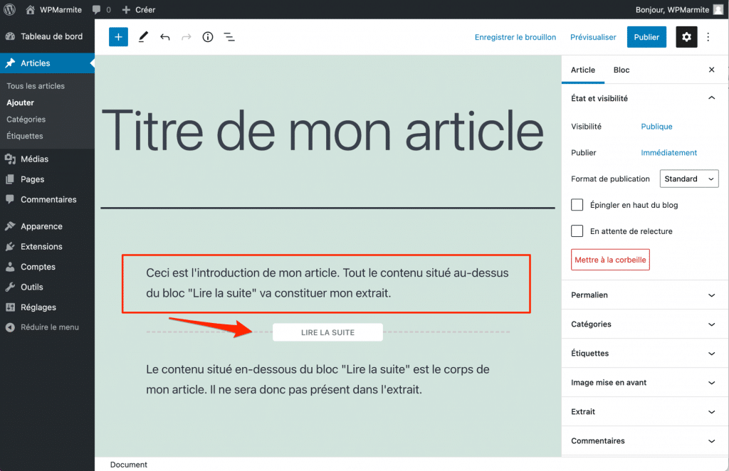 Ajout du bloc « Lire la suite » sur l’interface d’édition d’un article WordPress avec le thème Twenty Twenty-One.